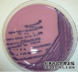 用植绒采样拭子在显色培养基上进行细菌检测